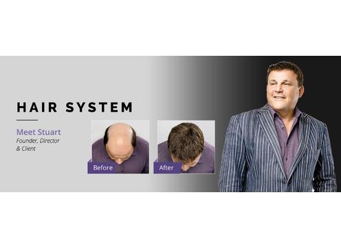 gallery image of Superior Hair Replacement